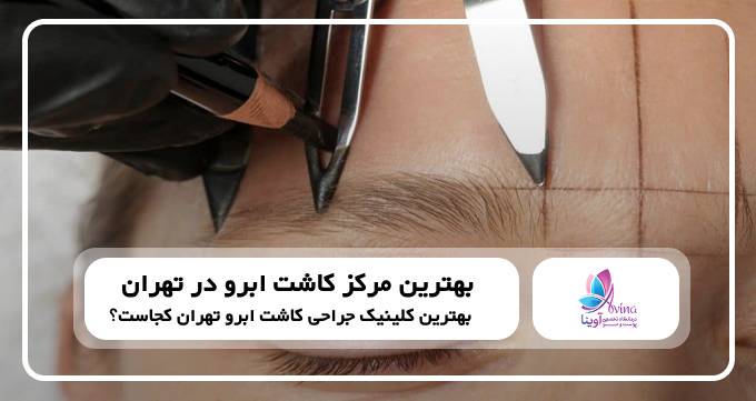 بهترین مرکز کاشت ابرو در تهران