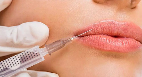 مراحل اجرای ژل لب عروسکی