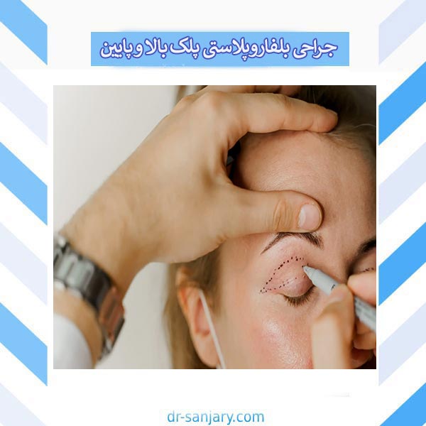 بررسی تفاوت های بلفاروپلاستی پلک بالا و پایین برای انتخاب هوشمندانه