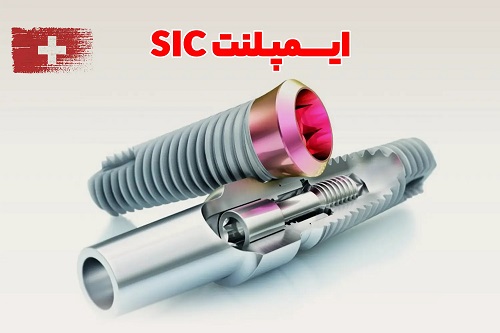 ایمپلنت سوئیسی SIC؛ راز ماندگاری لبخند بیماران سخت‌پسند در تهران